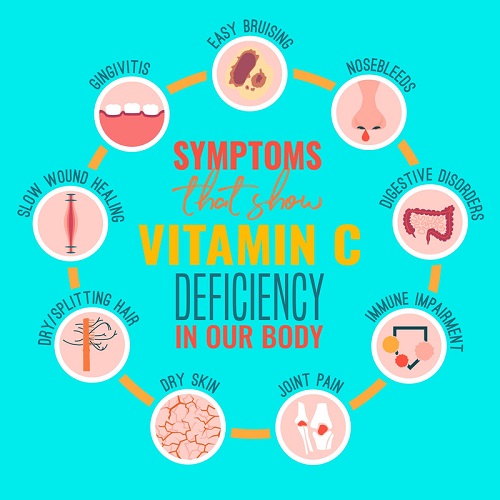symptoms of vitamin c deficiency
