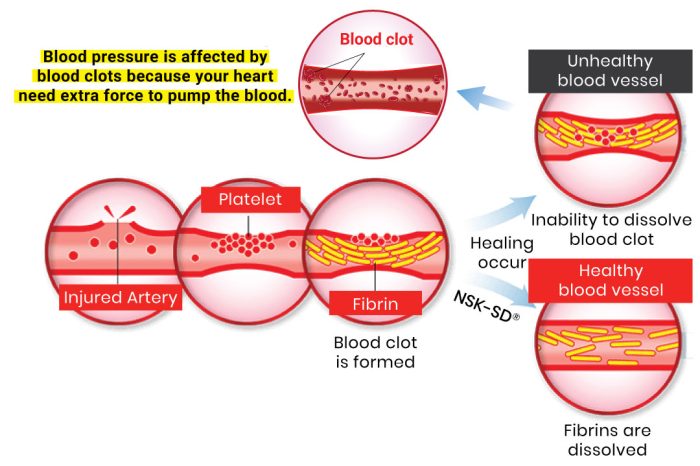 nattokinase blood clot